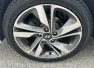 2016 Hyundai Elantra Limited